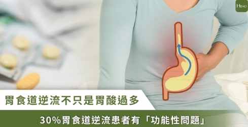 胃食道逆流自然療法
