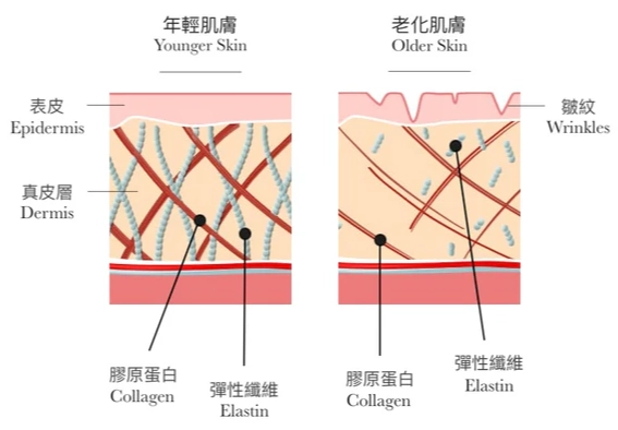 皮膚膠原蛋白流失 皮膚膠原蛋白流失