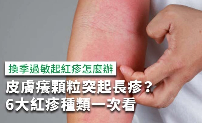 廿四味 濕疹 廿四味 濕疹