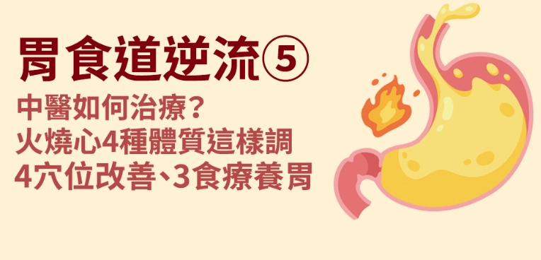 中醫逆流症狀 中醫逆流症狀