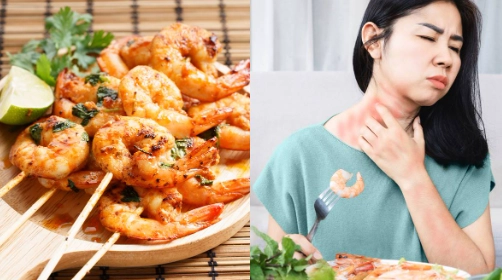 蝦子膽固醇高 蝦子膽固醇高