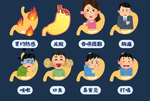 中醫逆流症狀 中醫逆流症狀