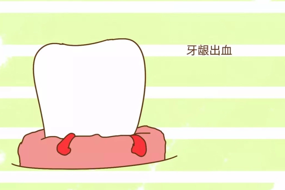 牙齦保健方法