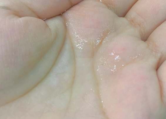 杏仁酸功效 杏仁酸功效